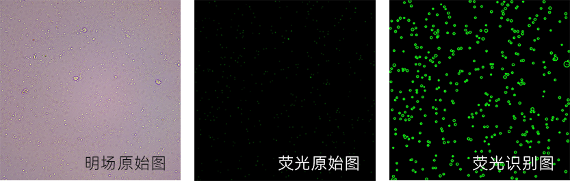 圖像法自動(dòng)化的血小板計(jì)數(shù)