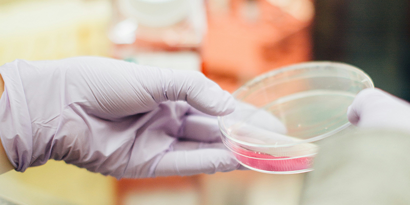 活菌計數(shù)效率瓶頸如何破？博大博聚微生物細(xì)胞計數(shù)儀的實踐方案