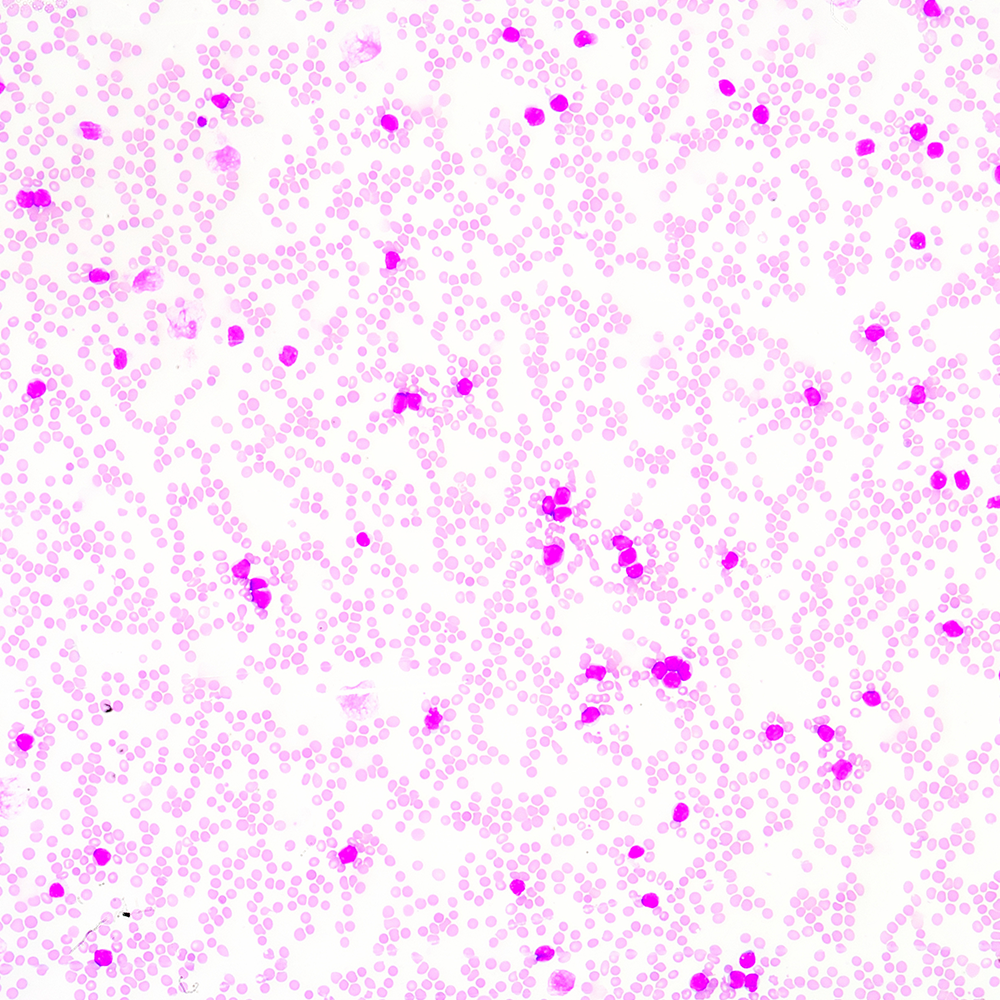 臺盼藍(lán) VS AOPI：細(xì)胞活率計數(shù)，哪種染色更合你意？